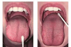 মুখের তলায় কাতুকুতু দিন ১ মিনিটে হেঁচকি বন্ধ করুন!