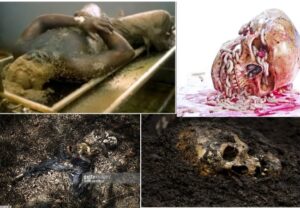 মৃতদেহের পচন প্রক্রিয়া,মৃতদেহ/লাশ পচার কারণ