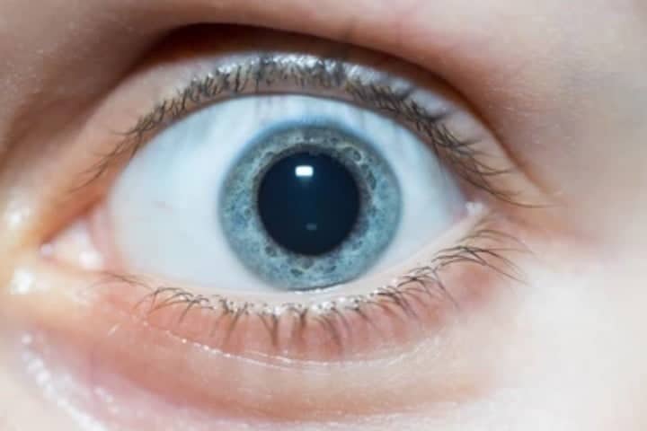 চোখের মণিতে বড় হয়ে যায়