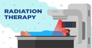 রেডিয়েশন থেরাপি কী? রেডিও থেরাপি কখন,কেন,কিভাবে দেয়া হয়?