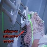 রেডিয়েশন থেরাপি কী? রেডিও থেরাপি কখন,কেন,কিভাবে দেয়া হয়?