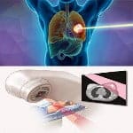 রেডিয়েশন প্রয়োগ