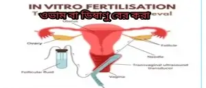 মানব ক্লোনিং কী? কিভাবে মানুষের ক্লোন করা হয়? অনিষিক্ত ডিম্বকোষ সংগ্রহ