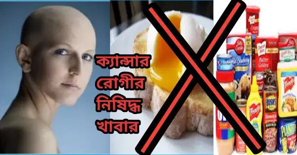 ক্যান্সার রোগীর নিষিদ্ধ খাবার|১৫টি খাবার খাবেন না# ক্যান্সার রোগীর নিষিদ্ধ খাবার|১৫টি খাবার খাবেন না#