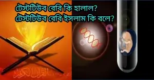 টেস্টটিউব বেবি হারাম না হালাল? টেস্ট টিউব বেবি হারাম না হালাল?
