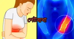 পাদ আটকে রাখার অপকারিতা# পাদ আটকে রাখলে পেট ব্যথা হতে পারে