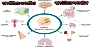 ব্যাকটেরিয়ার অপকারিতা