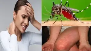 চিকুনগুনিয়া রোগ কী?চিকুনগুনিয়া লক্ষণ ও প্রতিরোধ!