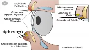 চোখে অঞ্জনি হয় কেন?