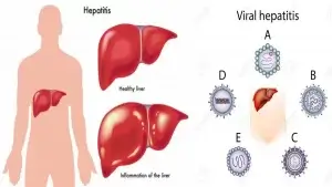 ভাইরাল হেপাটাইটিস কী?হেপাটাইটিস প্রকারভেদ ও প্রতিরোধের উপায়!
