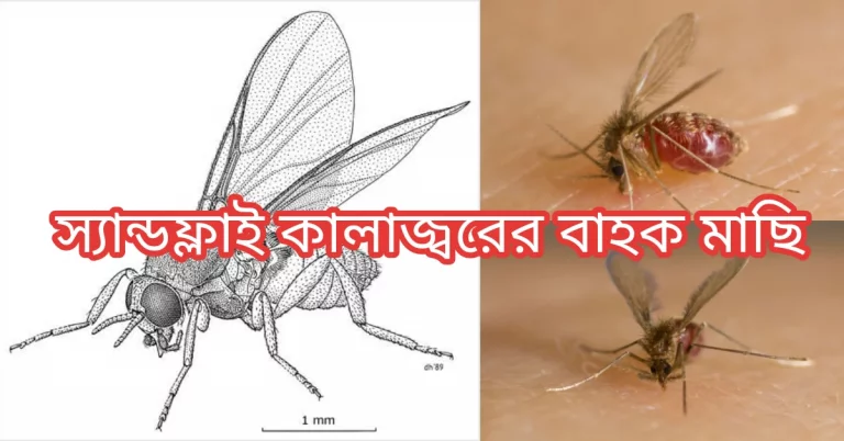 কালাজ্বর কী? কালাজ্বর এর লক্ষণ ও প্রতিরোধ! বেলেমাছি বা স্যান্ডফ্লাই