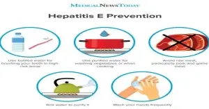 হেপাটাইটিস ই প্রতিরোধের উপায়