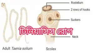টিনিয়াসিস রোগ কী? ফিতাকৃমি যে রোগ ছড়ায়! টিনিয়াসিস রোগ কী? ফিতাকৃমি যে রোগ ছড়ায়!