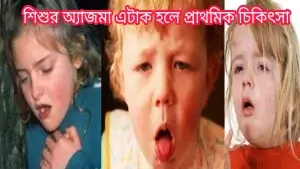 শিশুর ফুসফুসের রোগ ও তার প্রতিকার! শিশুর ফুসফুসের রোগ ও তার প্রতিকার!